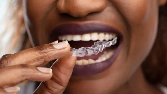 Byte Aligners